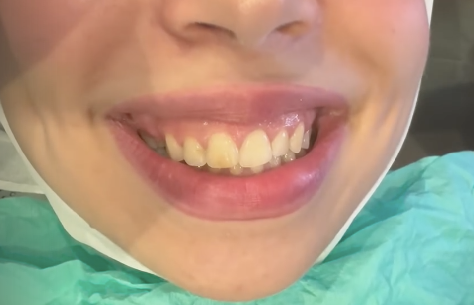 قبل